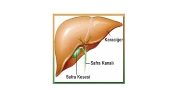 Safra Kesesi Ameliyatı
